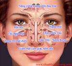 Bài thuốc trị viêm xoang mạn tính